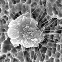 インプラントの素材『チタン』の安全性